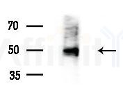 CTPS2 Antibody - Western blot analysis of extracts from Rat brain, using CTPS2 Antibody at 1/1000 dilution.