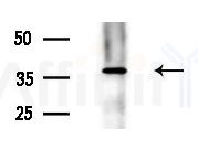 Cytohesin2 Antibody - Western blot analysis of extracts from B16F10-LUC cells
(LPS 4h treatment), using Cytohesin2 Antibody at 1/1000 dilution.