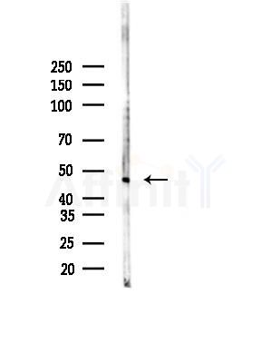 Cytohesin2 Antibody - Western blot analysis of lysates from B16F10-LUC cells(LPS,4h treatment), using Cytohesin2 Antibody at 1/1000 dilution.