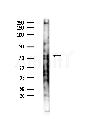 DBNL Antibody - Western blot analysis of lysates from Mouse testis, using DBNL Antibody at 1/1000 dilution.