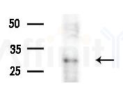 DCUN1D5 Antibody - Western blot analysis of extracts from B16F10-LUC cells
(LPS 4h treatment), using DCUN1D5 Antibody at 1/1000 dilution.