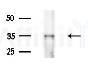 DCUN1D5 Antibody - Western blot analysis of extracts from Mouse liver, using DCUN1D5 Antibody at 1/1000 dilution.