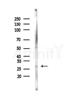 DCUN1D5 Antibody - Western blot analysis of lysates from B16F10-LUC cells(LPS,4h treatment), using DCUN1D5 Antibody at 1/1000 dilution.
