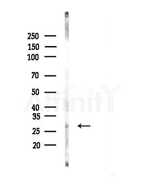 DCUN1D5 Antibody - Western blot analysis of lysates from Mouse liver, using DCUN1D5 Antibody at 1/1000 dilution.
