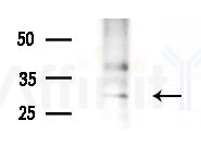 DDIT4L Antibody - Western blot analysis of extracts from B16F10-LUC cells
(LPS 4h treatment), using DDIT4L Antibody at 1/1000 dilution.