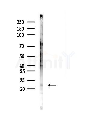 DDIT4L Antibody - Western blot analysis of lysates from B16F10-LUC cells(LPS,4h treatment), using DDIT4L Antibody at 1/1000 dilution.