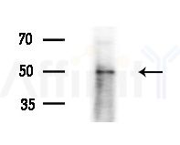 DMKN Antibody - Western blot analysis of extracts from Rat brain, using DMKN Antibody at 1/1000 dilution.