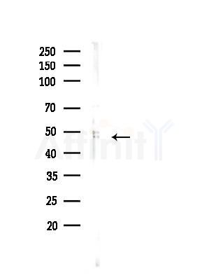 DMKN Antibody - Western blot analysis of lysates from B16F10-LUC cells(LPS,4h treatment), using DMKN Antibody at 1/1000 dilution.