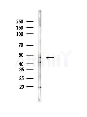 DMKN Antibody - Western blot analysis of lysates from Rat brain, using DMKN Antibody at 1/1000 dilution.
