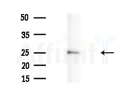 FAM3C Antibody - Western blot analysis of extracts from Mouse liver, using FAM3C Antibody at 1/1000 dilution.