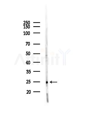 FAM3C Antibody - Western blot analysis of lysates from HepG2 cells(heat-shock,45min treatment), using FAM3C Antibody at 1/1000 dilution.