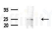 GSTA2 Antibody - Western blot analysis of extracts from B16F10-LUC cells
(LPS 4h treatment), using GSTA2 Antibody at 1/1000 dilution.