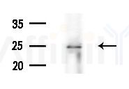 GSTA2 Antibody - Western blot analysis of extracts from Mouse liver, using GSTA2 Antibody at 1/1000 dilution.