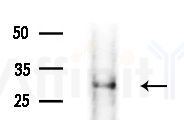 GSTA3 Antibody - Western blot analysis of extracts from B16F10-LUC cells
(LPS 4h treatment), using GSTA3 Antibody at 1/1000 dilution.