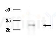 GSTO2 Antibody - Western blot analysis of extracts from B16F10-LUC cells
(LPS 4h treatment), using GSTO2 Antibody at 1/1000 dilution.