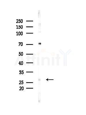 GSTO2 Antibody - Western blot analysis of lysates from B16F10-LUC cells(LPS,4h treatment), using GSTO2 Antibody at 1/1000 dilution.