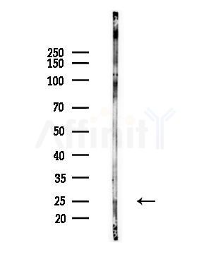 GSTT2B Antibody - Western blot analysis of lysates from LoVo cells(heat-shock,45min treatment), using GSTT2B Antibody at 1/1000 dilution.