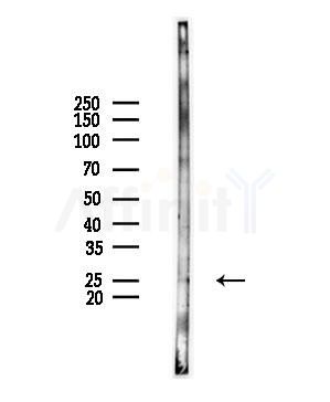 GSTT2B Antibody - Western blot analysis of lysates from HUVEC cells(UV,30min treatment), using GSTT2B Antibody at 1/1000 dilution.