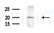 HDGFRP3 Antibody - Western blot analysis of extracts from 3T3-L1 cells
(heat-shock treatment), using HDGFRP3 Antibody at 1/1000 dilution.