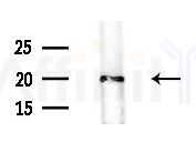 HDGFRP3 Antibody - Western blot analysis of extracts from Rat brain, using HDGFRP3 Antibody at 1/1000 dilution.