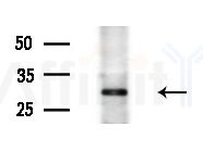HDGFRP3 Antibody - Western blot analysis of extracts from Mouse liver, using HDGFRP3 Antibody at 1/1000 dilution.