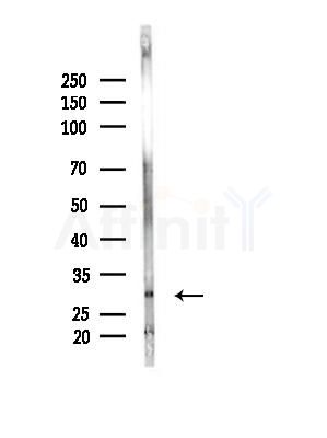 HDGFRP3 Antibody - Western blot analysis of lysates from Mouse liver, using HDGFRP3 Antibody at 1/1000 dilution.
