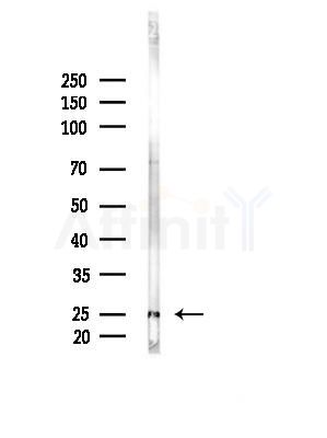 HDGFRP3 Antibody - Western blot analysis of lysates from Rat brain, using HDGFRP3 Antibody at 1/1000 dilution.