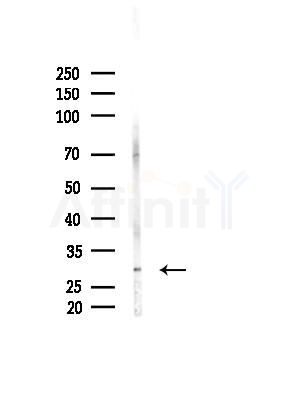 HDGFRP3 Antibody - Western blot analysis of lysates from 3T3-L1 cells(heat-shock, 45min treatment), using HDGFRP3 Antibody at 1/1000 dilution.