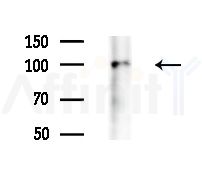 HELLS Antibody - Western blot analysis of extracts from Raji cells(heat-shock treatment), using HELLS Antibody at 1/1000 dilution.