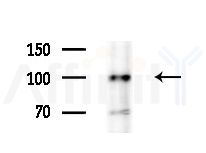 HELLS Antibody - Western blot analysis of extracts from Hela cells(heat-shock treatment), using HELLS Antibody at 1/1000 dilution.
