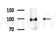 HELLS Antibody - Western blot analysis of extracts from Mouse brain, using HELLS Antibody at 1/1000 dilution.