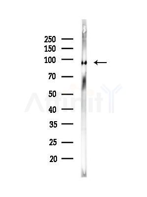 HELLS Antibody - Western blot analysis of lysates from Mouse brain, using HELLS Antibody at 1/1000 dilution.