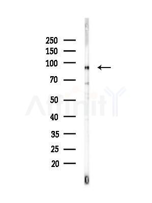 HELLS Antibody - Western blot analysis of lysates from Hela cells(heat-shock,45min treatment), using HELLS Antibody at 1/1000 dilution.