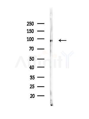 HELLS Antibody - Western blot analysis of lysates from Raji cells(heat-shock,45min treatment), using HELLS Antibody at 1/1000 dilution.