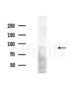 HPS4 Antibody - Western blot analysis of extracts from Hela cells(starvation, 24h treatment), using HPS4 Antibody at 1/1000 dilution.