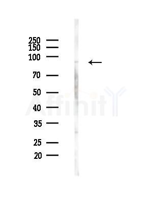 HPS4 Antibody - Western blot analysis of lysates from Hela cells(starvation, 24h treatment), using HPS4 Antibody at 1/1000 dilution.