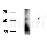 IgG4 Antibody - Western blot analysis of extracts from Rat liver, using IgG4 Antibody at 1/1000 dilution.