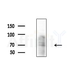 IMPDH1 Antibody - Western blot analysis of extracts from Hela cells(starvation, 24h treatment), using IMPDH1 Antibody at 1/1000 dilution.