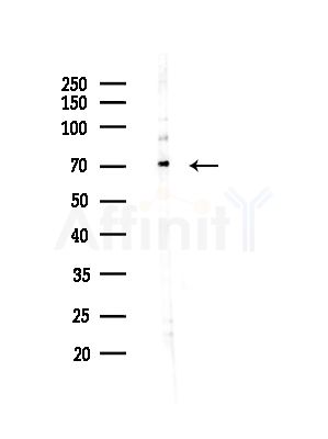 INTS10 Antibody - Western blot analysis of lysates from Hela cells(starvation,24h treatment), using INTS10 Antibody at 1/1000 dilution.