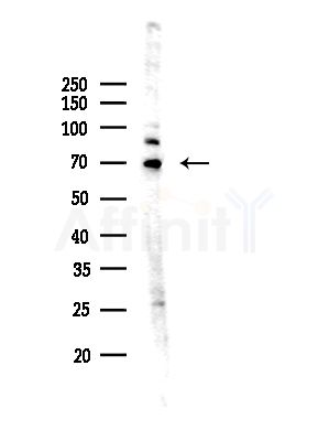 INTS10 Antibody - Western blot analysis of lysates from A375 cells(heat-shock,45min treatment), using INTS10 Antibody at 1/1000 dilution.