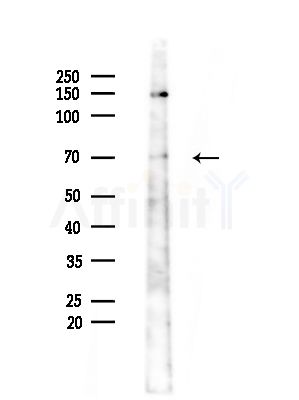 INTS10 Antibody - Western blot analysis of lysates from Mouse testis, using INTS10 Antibody at 1/1000 dilution.