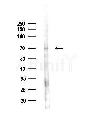 INTS10 Antibody - Western blot analysis of lysates from Rat brain, using INTS10 Antibody at 1/1000 dilution.