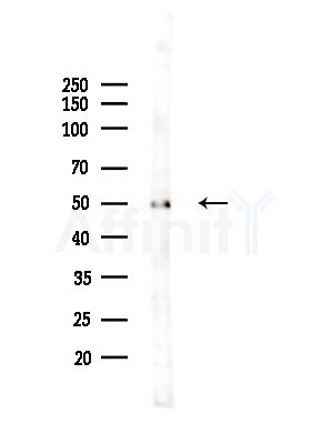 IRF1 Antibody - Western blot analysis of lysates from Hela cells(starvation,24h treatment), using IRF1 Antibody at 1/1000 dilution.