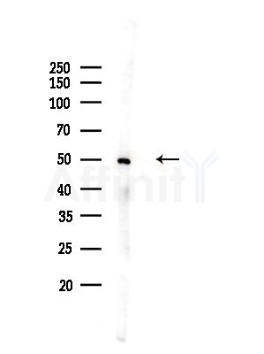 IRF1 Antibody - Western blot analysis of lysates from A375 cells(heat-shock,45min treatment), using IRF1 Antibody at 1/1000 dilution.