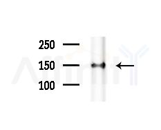 SSFA2 Antibody - Western blot analysis of extracts from Mouse brain, using SSFA2 Antibody at 1/1000 dilution.