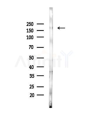 SSFA2 Antibody - Western blot analysis of lysates from Mouse brain, using SSFA2 Antibody at 1/1000 dilution.