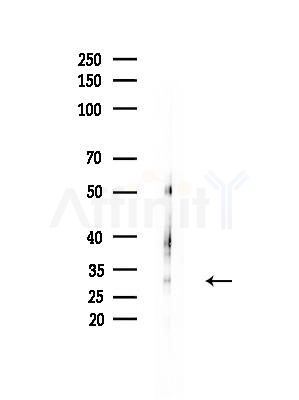 LDB3 Antibody - Western blot analysis of lysates from Mouse muscle, using LDB3 Antibody at 1/1000 dilution.