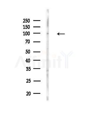 MCC Antibody - Western blot analysis of lysates from MDA-MB-231 cells(heat-shock, 45min treatment), using MCC Antibody at 1/1000 dilution.