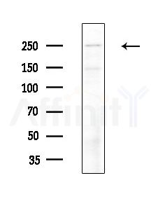 MED12 Antibody - Western blot analysis of extracts from Hela cells(starvation, 24h treatment), using MED12 Antibody at 1/1000 dilution.