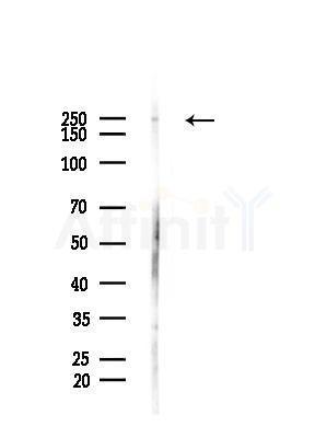 MED12 Antibody - Western blot analysis of lysates from Hela cells(starvation, 24h treatment), using MED12 Antibody at 1/1000 dilution.